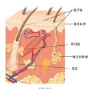 피지샘 낭종 이미지