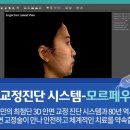 3D안면비대칭교정