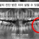 광혜치과의원 네이버블로그