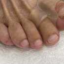 레푸스인하대역점 내성발톱 무좀발톱 발각질 문제성발 이미지