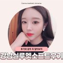 위버스성형외과의원 | 강남 실루엣소프트 후기와 같이 꼭 알아보자