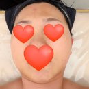 젤라 피부관리 | 동두천피부관리 '글리터온' 솔직후기! (가격, 프로그램, 주차 정보)