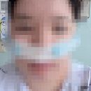 김지희머리사랑 | 누군가에게 힘이되고 싶어 작성하는 뇌하수체선종 수술후기