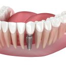 우리신평치과의원 이미지