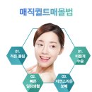 수원눈성형 일상복귀가 빠른 매직퀼트!