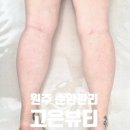 고은뷰티 | 원주바디관리 붓기케어 제대로 받은 고은뷰티 하체관리 후기