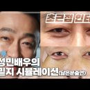 (이성민 배우 닮은꼴 출연) 눈밑지가 필수 중년 성형인 이유! 인상이 환해지는 눈밑지방재배치 이미지