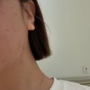 아임팜 - 제주시 중산간서로 5336 | 광주 북구 신안동 피부관리 에스테틱 | 아임뷰티 내돈내산 후기