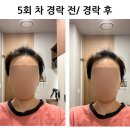 W-약손 | [W-18.신부관리-경락후기] 약손명가 후기/ 약손명가 웨딩케어 후기/ 약손명가 K-뷰티 후기