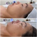 유포리아 에스테틱 이미지
