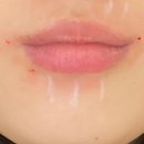 톱스타성형외과