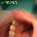 심포니치과기공소 이미지