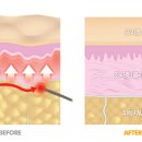 블루밍의원 이미지