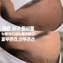 대전문정초교 | 대전 피부관리 누아뷰티샵 &amp; 에어바디 스킨플래닝 '탕후루플래닝' 후기