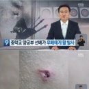 양궁부에서 학교폭력이 발생하자 양궁협회가 한일 이미지