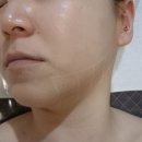 [수원 영통 피부관리] 이중턱 소멸을 위한 V 이중컷팅 조각술 &#34;포이에마피부샵&#34; 내돈내산 후기
