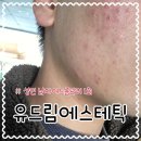 드림 | 울산 성인남자여드름 관리 1회차 달동 유드림에스테틱 후기