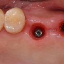 플란치과기공소 이미지