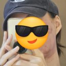 더힐피부과의원 | 30만원 내고 얼굴 뚜까 맞은 사람의 더힐 피부과의원 인모드 후기