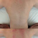 유코치의 슬림해짐 | 평택 고덕 바디관리 추천 “앤드유뷰티스튜디오” 솔직후기 승모근관리 효과 대박