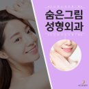 숨은그림성형외과