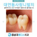 (주)메디스 | 대연동사랑니발치, 클릭하시는 순간 두려움이 절반으로 줄어듭니다