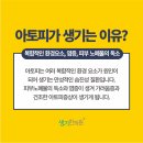 명중 태양광 이미지