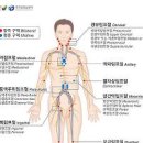 혈액암 증상 및 생존율 (림프종) 이미지