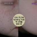 불당사랑내과의원 | {천안, 신불당, 쁘띠, 피부과, 추천!} 천안스노우의원 불당점 천안 피부과 추천