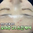 스킨프라자21 | 천안 여드름 관리 전문 '오마주 21 스킨케어' 여드름관리 &amp; 압출 후기