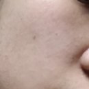 엘케이메딕스 | [LKROP]엘케이 알오피 비타하모니 플러스 톤업앰플