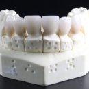 덴탈맑음기공소 이미지