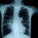 잠실어린이집 이미지