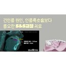 뉴욕스마일치과의원 | 수술 전 '위턱뼈 길이'를 체크해야 하는 이유 [부산교정전문의 교정치과 해운대좌동 뉴욕스마일치과의원]