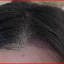 모모성형외과의원 이미지