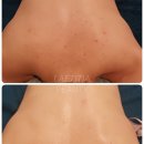 천안 RPC 이미지