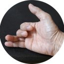 손가락 오그라짐(디스토니아,Distonia)에 벌침이 효과 있을까요? 이미지