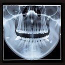 덴탈스케치치과기공소 | 갑분치통! 이럴 땐 묻지도 따지지도 말고 여기로 가야 함