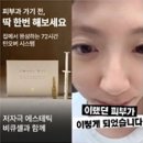 뷰케팅 | 뷰티 광고 roas 로아스가 150%에서 멈추는 진짜 이유 (대행사의 진짜 역할)