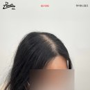 레이븐스칼프