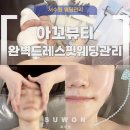 아꼬뷰티 | 서수원웨딩관리 아꼬뷰티 등 어깨 승모근 작은얼굴까지 완벽드레스핏 풀코스