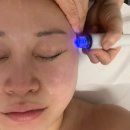 대구대명동우체국 화장실 | 대구 남구 라플러스에스떼 아쿠아필 윤곽 관리 대명동피부관리 후기