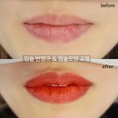 미코뷰티 | 대구입술문신 입꼬리교정 후기[동성로미코뷰티]