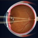 아이프렌드 안경 이미지