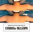 4850 | 송도 에스테틱 봄여름 맞이 오프숄더 어깨팔뚝 관리 만족 후기