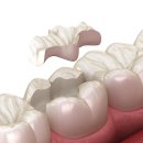 현대치과기공소 이미지