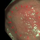 메트로속내과의원 이미지