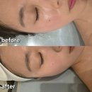 월곡중앙로1번길 | 월곡피부관리 타라테라피 홍조 피부열감내리기 플라즈마 관리