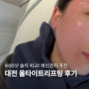 대전 급한일정, 예신관리 추천 올타이트리프팅 600샷 후기
