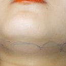 연세메디의원 이미지